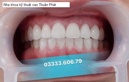 Hình ảnh Nha khoa kỹ thuật cao Thuận Phát